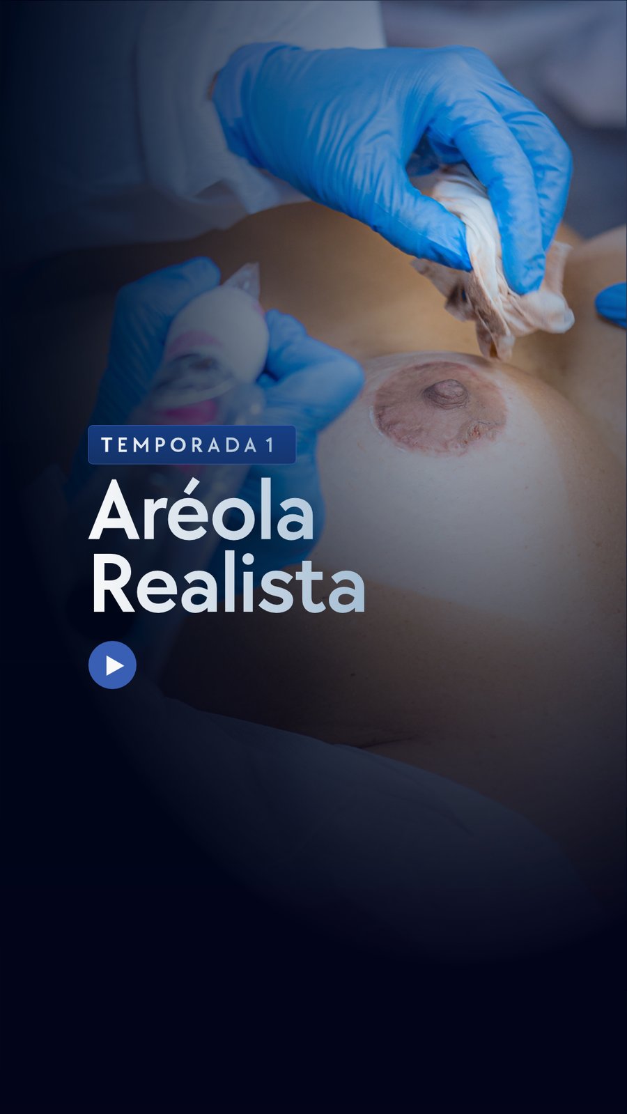 Temporada 1 — Aréola Realista