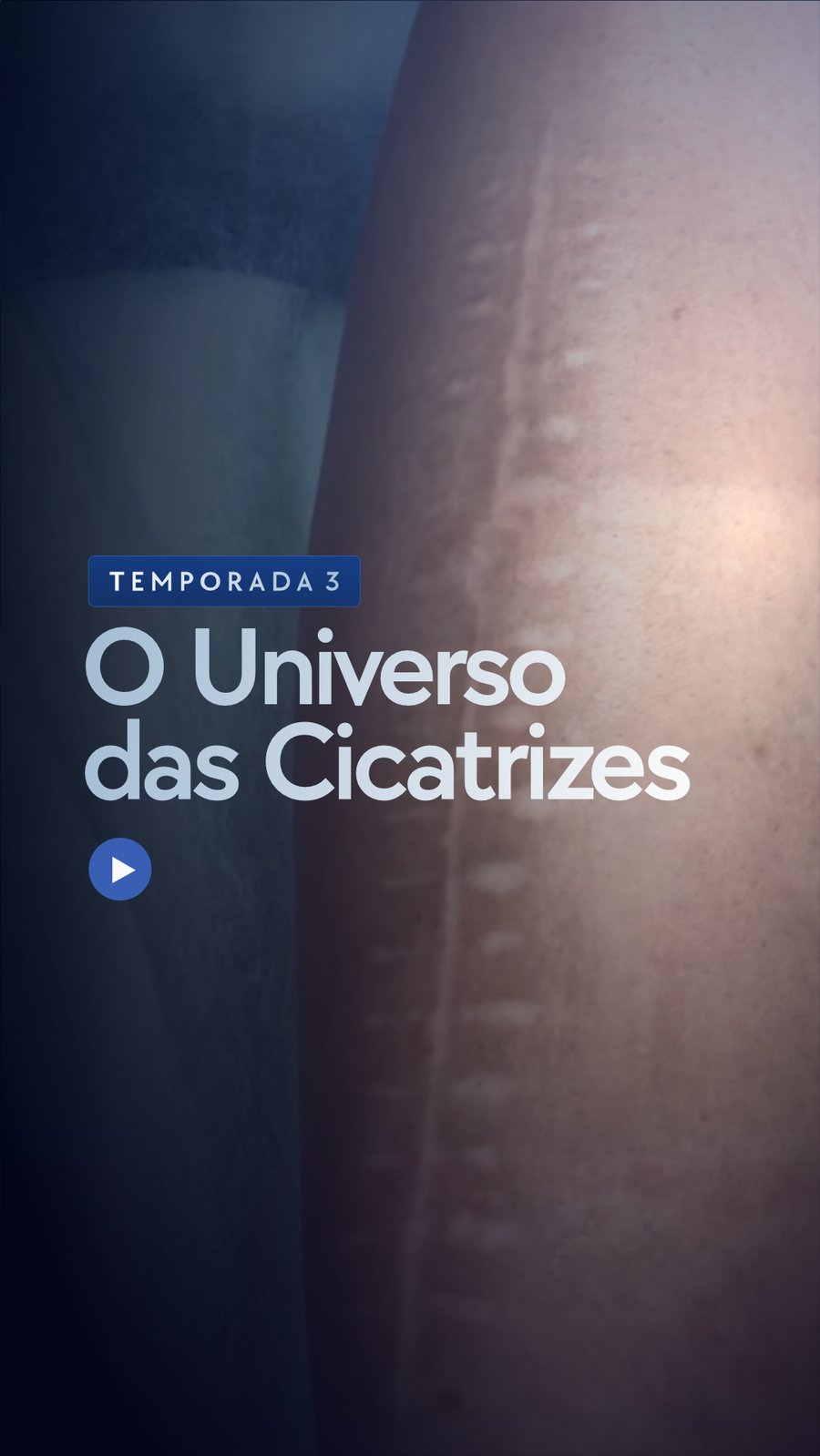 Temporada 3 — Cicatrizes
